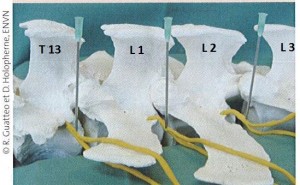 para prox guatteo et holo-point veto 2008 chir et anesth