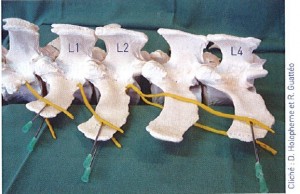 paradistal gtv 44 mai 2008